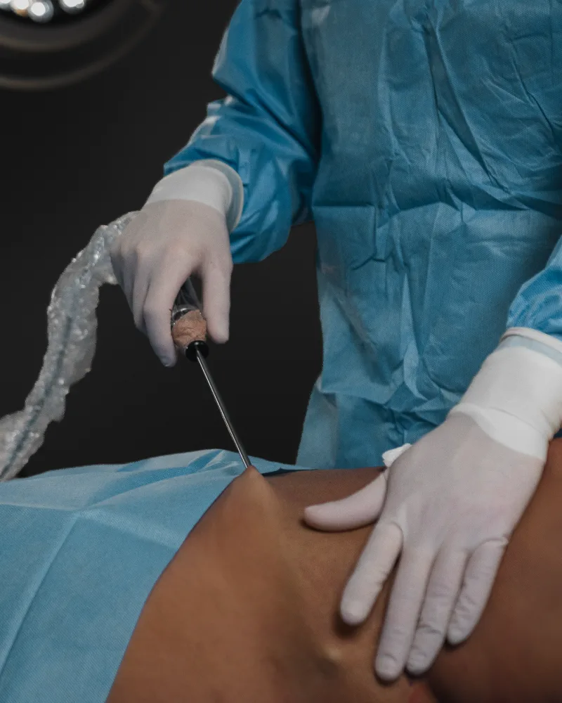 Procedimiento con Dorian en quirófano